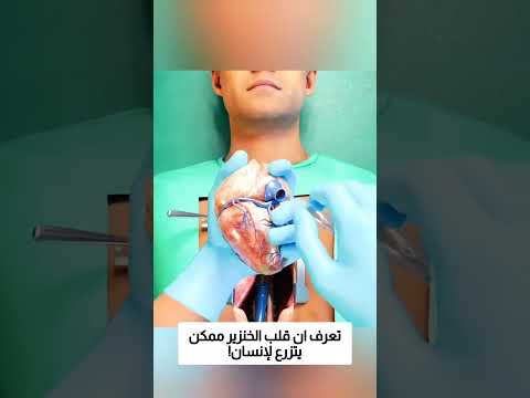 تعرف ان قلب الخنزير ممكن يتزرع لإنسان! thumbnail