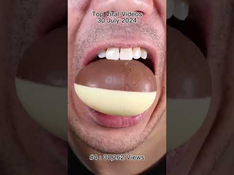 Satisfying Chewing ASMR #Compilation #ASMR #DoctorTristanPeh thumbnail