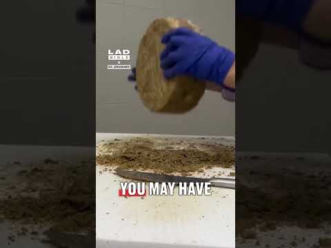 All the cheese is furry 🥴🧀 #food #cheese #interesting thumbnail