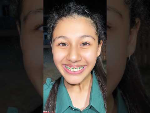 เมื่อลูกขอดัดฟัน แจ๋วเกิ๊น!! 🤣 555 #funny #comedy #drama #humor #memes #youtube #shorts #minmayang thumbnail