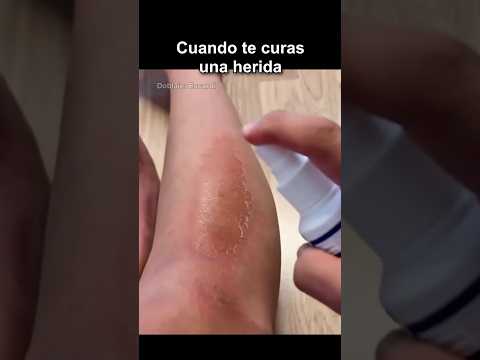 CUANDO TE CURAS UNA HERIDA thumbnail