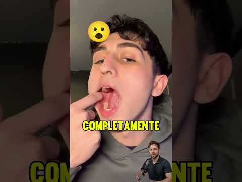¡Este joven puede esconder una pastilla en su boca! 😮💊 thumbnail