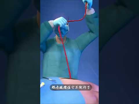 一根形似牙籤的彈簧憑什麼價值上萬？#shorts | #紀錄片 #有趣  #creative thumbnail