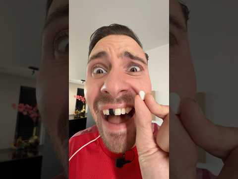 Rutger zijn tand is eruit! 😱 thumbnail