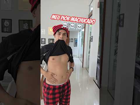 Piores machucados que eu ja fiz ☠️ #shorts thumbnail