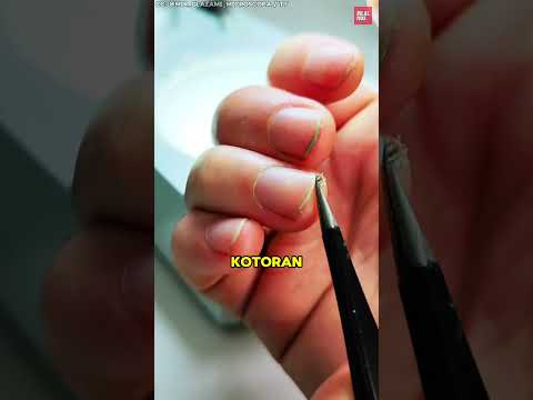 Mengapa Kalian Harus Berhenti Menggigit Jari thumbnail
