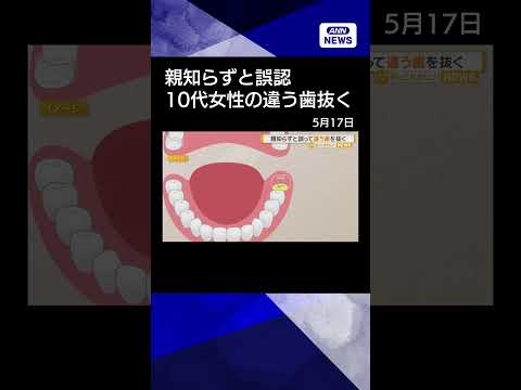 親知らずと誤認　歯茎に埋もれた別の歯を抜く　福井大病院　10代女性患者に謝罪#shorts thumbnail
