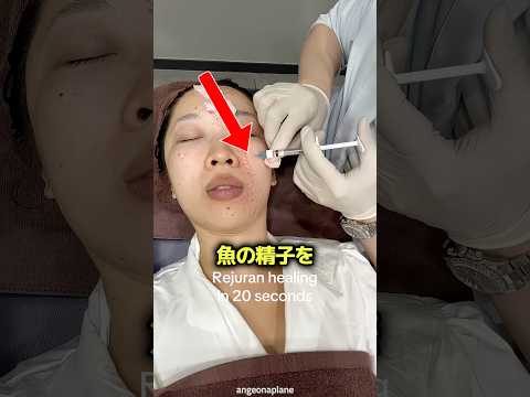 魚の精子を顔に入れる理由 ? thumbnail