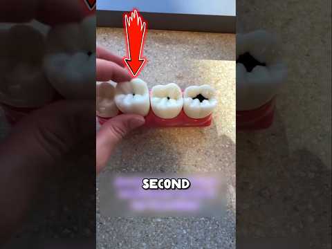 Tooth Decay ? thumbnail