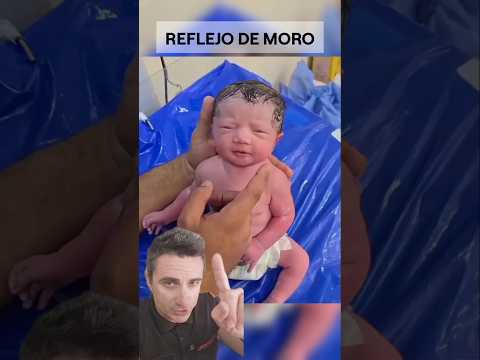 Reflejo de moro.#supervivencia #curiosidades #sabíasque thumbnail