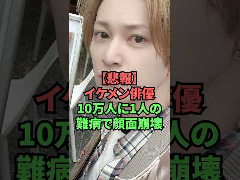【悲報】イケメン俳優10万人に1人の難病で顔面崩壊 thumbnail