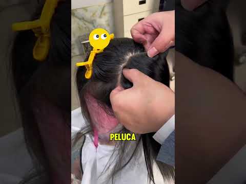 ¡La chica está muy triste porque no tiene cabello! 😢👧 thumbnail