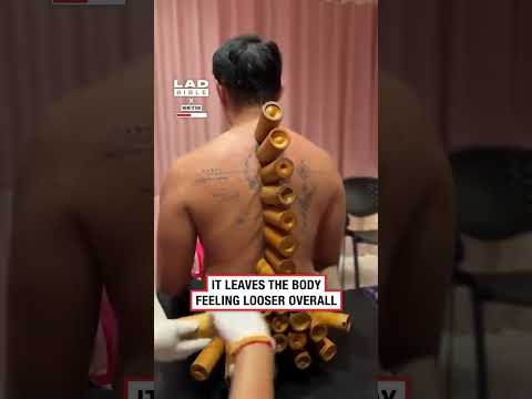 Bamboo cupping on my back 🥴💦 thumbnail