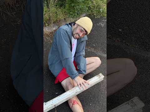 Quedé ATRAPADO con un TRONCO en mi PIERNA thumbnail