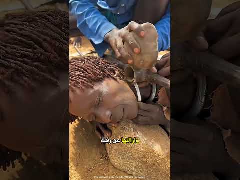 شاهد كيف يتم نزع طوق الرقبة الحديدي في القبائل البدائية 😲⛓️ thumbnail