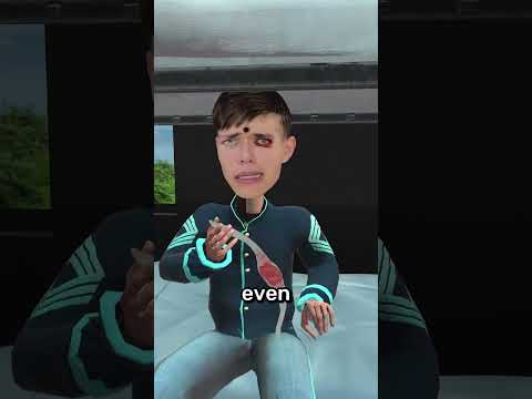 He Lived With a Bullet in His Head 😨 thumbnail