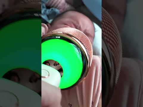 It works #baby thumbnail