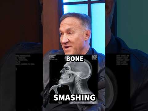 Plastic Surgeon Explains Bone Smashing thumbnail