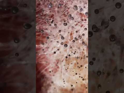 Weird 360° Microscopic Shot! thumbnail