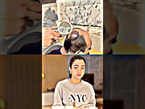 Direct vitamin D in the Head thumbnail