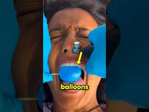 Balloon Sinuplasty Explained thumbnail