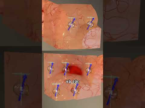 CÁCH HOẠT ĐỘNG CỦA MÁY MRI 🤯 | Đế Chế Công Nghệ thumbnail