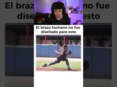 El Brazo Humano No Fue Creado Para Esto 💀 thumbnail