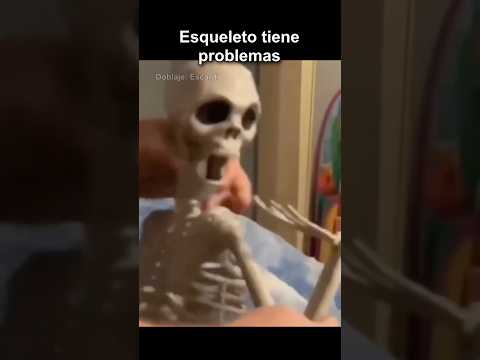 ESQUELETO TIENE PROBLEMAS thumbnail