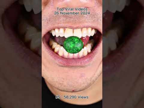 Satisfying Chewing ASMR #Compilation #ASMR #DoctorTristanPeh thumbnail