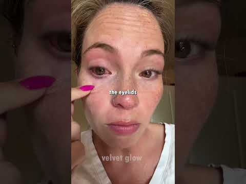 🚨 What To Do If Super Glue Gets In Your Eye thumbnail