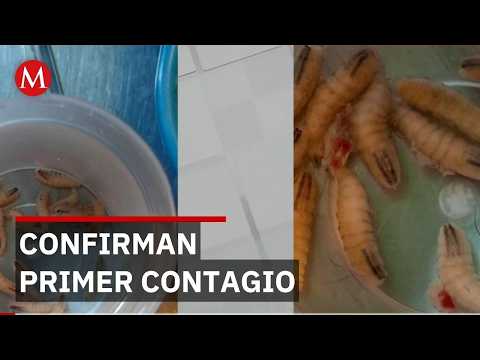 Secretaría de Salud confirma primer caso de gusano en persona en la CdMx thumbnail