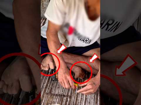 คุณปู่นิ้วแด๊น #funny thumbnail
