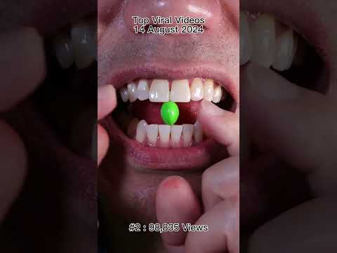 Satisfying Chewing ASMR #Compilation #ASMR #DoctorTristanPeh thumbnail