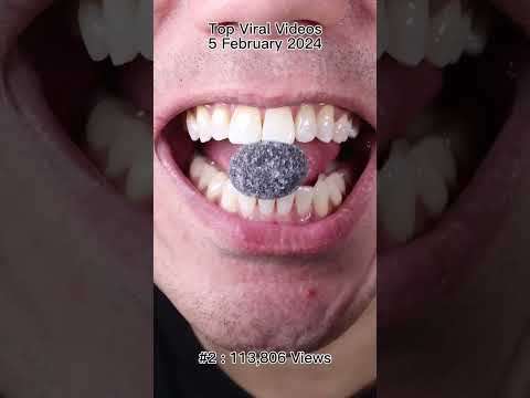 Satisfying Chewing ASMR #Compilation #ASMR #DoctorTristanPeh thumbnail