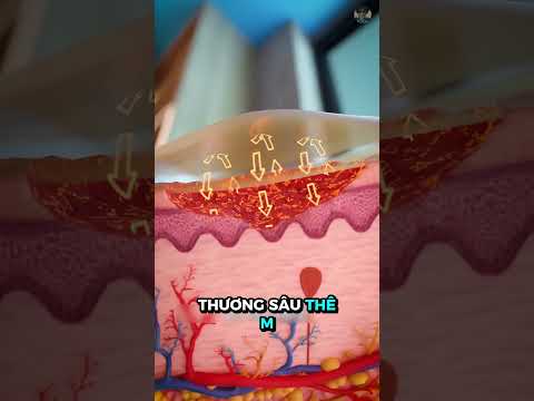 Cách sơ cứu vết bỏng một cách nhanh và hiệu quả nhất #kienthuc #giaitri thumbnail
