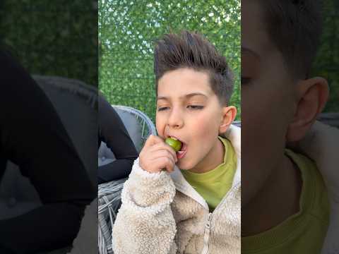 Göz hakkı thumbnail