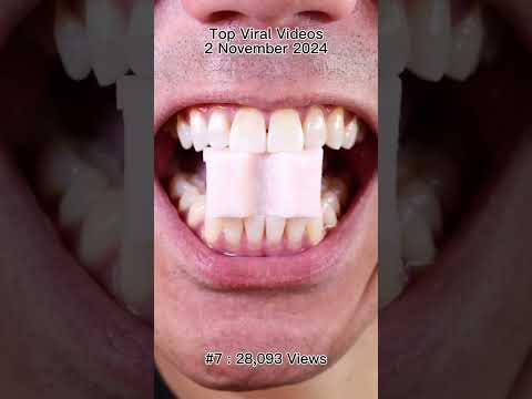 Satisfying Chewing ASMR #Compilation #ASMR #DoctorTristanPeh thumbnail