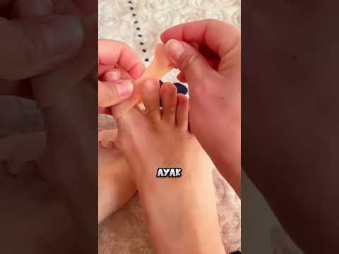 Hayat KURTARAN Aparat! 🦶❤️‍🩹 thumbnail