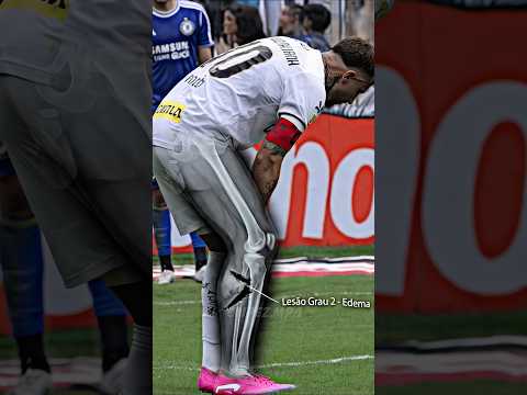 A CBF confirmou que Neymar pode ficar FORA da copa do mundo por conta da LESÃO thumbnail
