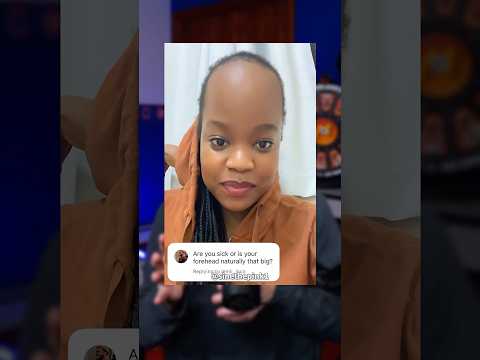 The Comments Roasted Her Forehead ? thumbnail