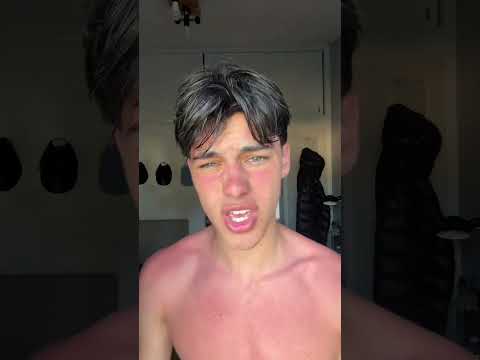 prima volta che prendo il sole e divento rosso pomodoro ? thumbnail