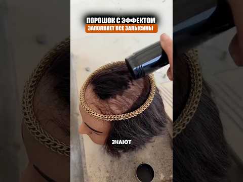 Эффективный метод от залысин thumbnail