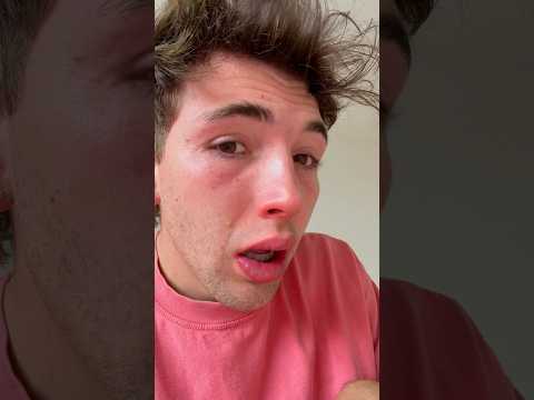 Estoy de regreso!! Pero muy enfermo…🤢🤮🤒 thumbnail