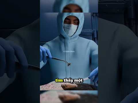 Xét nghiệm tử thi || +1 kiến thức #kienthucbosung #kienthucthuvi thumbnail