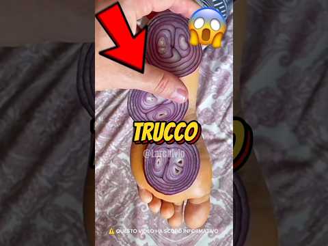 PERCHÉ DORMONO CON LE CIPOLLE NEI CALZINI ?! 😱 #curiosità #informative thumbnail
