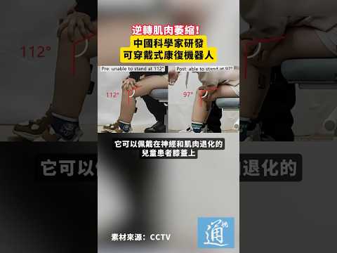 逆轉肌肉萎縮！中國科學家研發可穿戴式康復機器人#中國 #科技 thumbnail