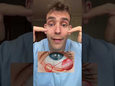 ¿Tienes esto? #datoscurisos #sabiasque #ojos thumbnail