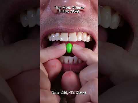 Satisfying Chewing ASMR #Compilation #ASMR #DoctorTristanPeh thumbnail