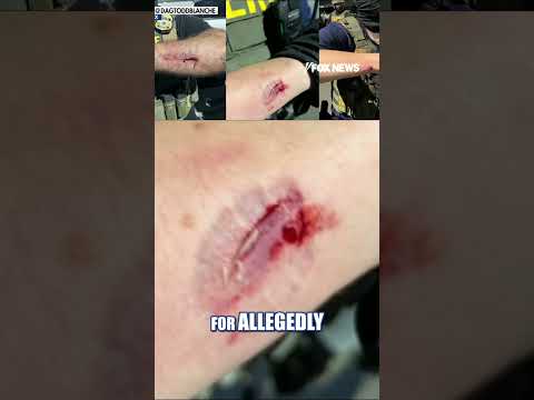Anti-ICE rioter CHARGED for allegedly ATTACKING FEDERAL AGENT #foxnews #news #us #fox thumbnail