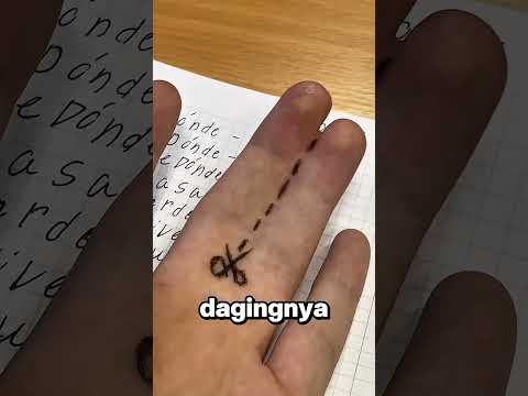 Terlihat Menyatu, Tapi Tulangnya Pisah? Kok Bisa! ? thumbnail